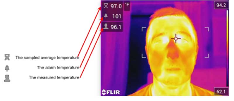 Thermal image of body temperature with explanation