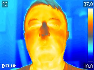 Thermal image of body temperature